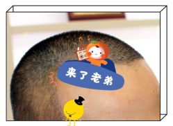 -大麦微针植发全国连锁