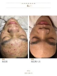 -LUNA皮相美·骨相美高级美感