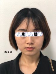 -八大处整形