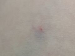 -中国人民解放军总医院