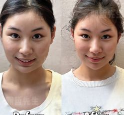 -颜和骨正&明星徒手小颜整骨