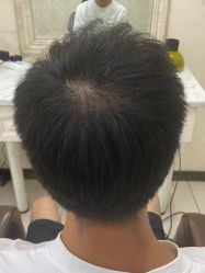 -唐风采假发补发定制
