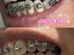 -瑞尔齿科(上海长风大悦城店)