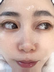 体验前-海涛医疗美容·面部抗衰·注射美鼻