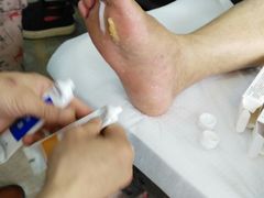 -郑远元专业修脚房(栖山路店)