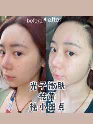 -AiCure 埃可儿·韩国医学皮肤管理