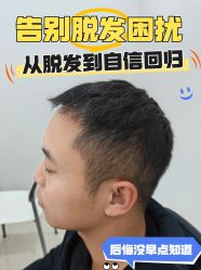 -雍禾植发全国连锁