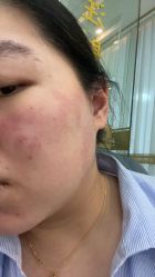 体验前-苏州卫康美容医院