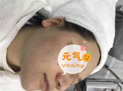 -痘博士天津·全国连锁祛痘机构