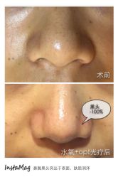 光SPA水氧+opt-光SPA科技美肤