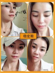 -广东韩妃整形外科医院