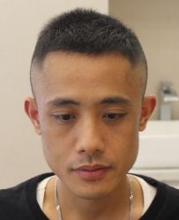 -大麦微针植发全国连锁