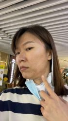 点击看大图 体验后-八大处整形