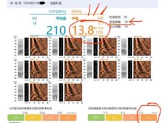 -爱康国宾体检中心(顺平分院)