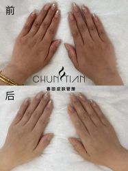 -春田皮肤管理中心品牌旗舰店