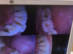 -爱牙联合口腔(门诊报销 海云庵店)