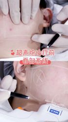 -Yestar 嘉兴艺星医疗美容医院