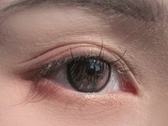 -苏州大学理想眼科医院