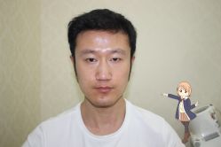 -大麦微针植发丨全国连锁