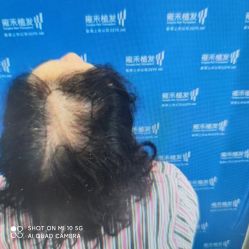 -雍禾植发全国连锁