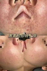 -春田皮肤管理中心品牌旗舰店