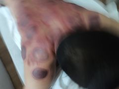 -深蓝盲人推拿·颈肩腰腿疼痛·艾灸调理(清河店)