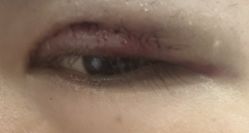 -广州美莱医疗美容医院