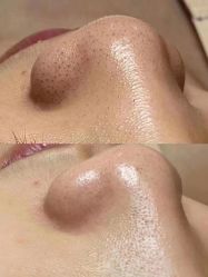 -美肤盾祛痘·问题肌头疗管理中心