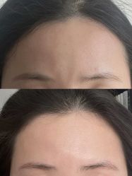 体验前-石家庄苏亚美联臣医疗美容医院