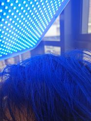 -碧莲盛·不剃发植发