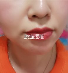 -YooMee优美智能科技美肤机构