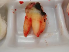 -上海市杨浦区牙病防治所