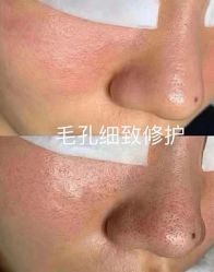 -美肤盾祛痘·问题肌头疗管理中心