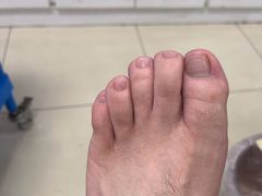 -朋朋修脚·灰指甲·甲沟炎·跖疣(人民路店)