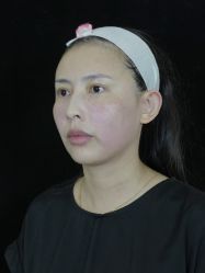 点击看大图 -Yestar重庆艺星医疗美容医院