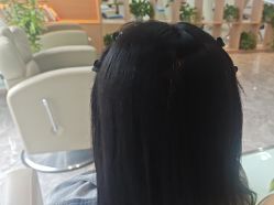 -碧莲盛·不剃发植发