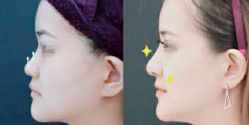 -SKINIST丽铂医疗美容