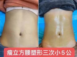 -瘦立方身材管理中心