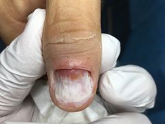 -Andrew指甲专科灰指甲·甲沟炎矫正·3D步态矫形鞋垫定制(上海法华镇路旗舰店)