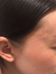 -海涛医疗美容·面部抗衰·注射美鼻