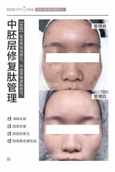-MLP美丽派·问题肌疗愈中心
