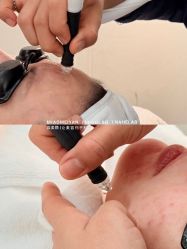 点击看大图 -MIAOLAB·韩国淼美颜皮肤管理