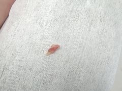 -新甲连锁甲沟炎灰指甲手足癣(中央大街店)