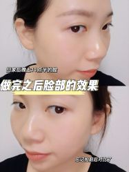 体验后-慕颜医疗美容·皮肤微整 抗衰