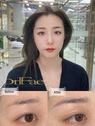 点击看大图 -OnFaer.纹眉半永久无创洗眉