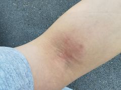 -清华大学玉泉医院