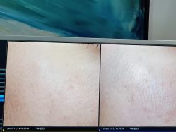 -苑苑vbeauty科技美容SPA