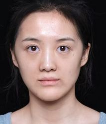 -云南吴氏嘉美医疗美容医院