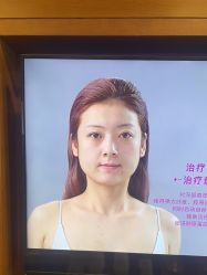 点击看大图 -苏亚医美·高端注射明星整形机构