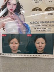 -深圳鹏爱秀琪医疗美容医院